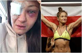 Do tego otwarta głowa, dużo kombinowała sama. Karolina Kowalkiewicz W Walce Ufc Doznala Powaznego Urazu Oka Lodzka Zawodniczka Mma Boi Sie Ze Straci Wzrok Express Ilustrowany