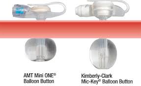 Difference Between A Mini And Mic Key Button Feeding Tube Awareness Gtube Feeding Tube