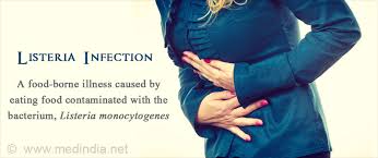 Symptoms of listeriosis are variable; Listeria Infection Causes Symptoms Risk Factors Diagnosis Complications Treatment Prevention