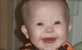 Max föddes med Down Syndrom