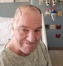 Friend visits after brain cancer surgery