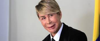 Fotogalería] Podemos reír: ¿Recuerda a Norberto? Así se veía antes de sus  cirugías estéticas