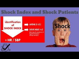 Image result for Shock Index