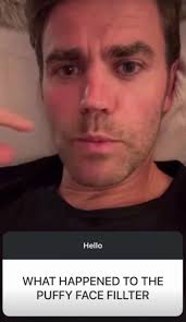 Paul Wesley Puffy Face