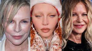 Kim Basinger, Madonna, Meg Ryan, Donatella Versace… Ces stars  métamorphosées après la chirurgie