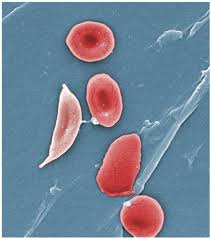 Image result for Red Blood Cell