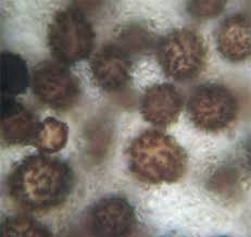 Image result for Scleroderma polyrhizon