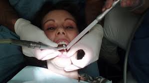 Omstreden tandarts Geertsema houdt er plotseling mee op