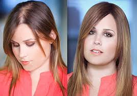It can be the result of heredity, hormonal changes, medical conditions or a normal part of aging. Women S Hair Loss Solutions Pittsburgh Pa Pittsburgh Hair Loss Replacement Treatment Clinic Pa