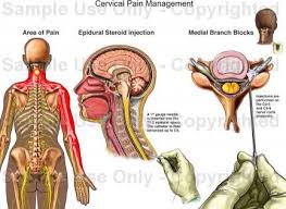 Pin On Chiari Crafts