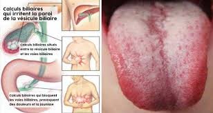Une peau en mauvaise santé une peau sèche ou grasse est le résultat d'une accumulation de toxines dans le corps. Ces 9 Signes Indiquent Que Vous Devez Eliminer Les Toxines De Votre Corps En Urgence Circulaire En Ligne