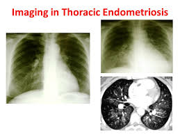 Journal of assisted reproduction and genetics. The Menstrual Cycle The Lung Ppt Video Online Download