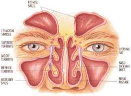 Check spelling or type a new query. Ghost Parasites And Severely Congested Sinuses From Medicineworld Org