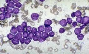 Image result for Rolapitant