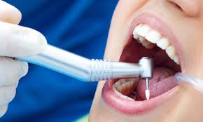 Are Dental Fillings Permanent? | Atrium ...