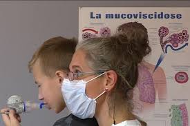 Ce gène est localisé en 7q31 et contient 27 exons. Dossier Sante La Mucoviscidose