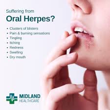 Image result for oral herpes symptoms roof of the mouth