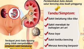 Ia terbentuk di dalam buah pinggang dan boleh bergerak ke bahagian saluran kencing yang lain. National Cancer Society Of Malaysia Penang Branch Kenali Tanda Batu Karang