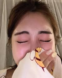 snow-white male, 9.5 months, everything is fine