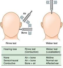 Image result for Tuning Fork Test