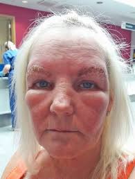 Granny's 'two black slugs' for eyebrows after Bristol beauty treatment