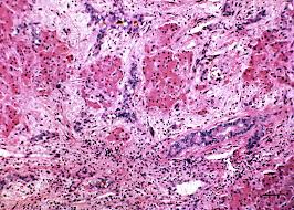 Image result for Crotalaria laburnoides