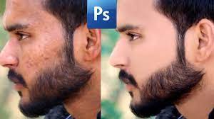 660 برنامج تصفيه الوجه طريقة ازالة الحبوب واثار حب الشباب youtube incoming call screenshot incoming call fitbit