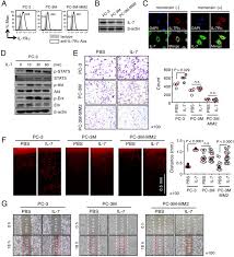 Psa testing is widely utilized as a screening test for prostate cancer in men. Interleukin 7 Contributes To The Invasiveness Of Prostate Cancer Cells By Promoting Epithelial Mesenchymal Transition Scientific Reports