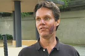 Blind man uses sonar to 'see'