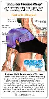 Cold Should Be Used For New Injuries Or Right After Re Injury Infraspinatus Muscle Bursitis Shoulder Shoulder Surgery