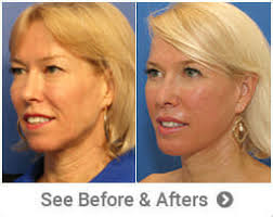 Plastic Surgeon Beverly Hills