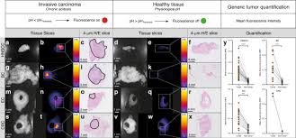 Permohonan ini dibuka pada bulan oktober 2020 menerusi laman web utem. Exploiting Metabolic Acidosis In Solid Cancers Using A Tumor Agnostic Ph Activatable Nanoprobe For Fluorescence Guided Surgery Nature Communications