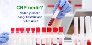 crp nedir neden yukselir hangi hastaliklarin belirtisidir