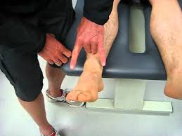 Image result for Ankle External Rotation Test