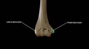 Medial and lateral epicondyles of the humerus. File Medial Epicondyle And Lateral Epicondyle Jpg Wikipedia