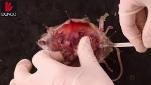 Check spelling or type a new query. Souris Ouverture De La Symphyse Pubienne Youtube