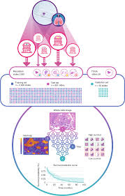 We also explore how it is diagnosed and the many treatment options now available should you be unfort. Deep Learning Based Classification Of Mesothelioma Improves Prediction Of Patient Outcome Nature Medicine