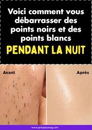Apprenez A Vous Debarrasser Des Points Noirs Et Des Points Blancs Pendant La Nuit En 2020 Point Noir Recette Beaute Astuces Beaute Visage