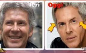 Use #baglionihotels #baglionimoments and share your experience with us! Striscia La Notizia Claudio Baglioni Scrive A Dagospia Io Fatto E Rifatto Cos E Successo Alla Mia Faccia Libero Quotidiano