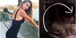 Jun 26, 2021 · son günlerin en çok konuşulan ismi şeyma subaşı'ndan sürpriz bir hamle geldi. Seyma Subasi Bebeginin Ilk Ultrason Fotografini Paylasti