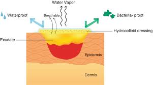 Image result for Chitosan Dressing