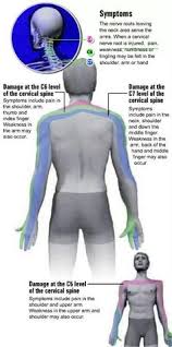 To look for signs of cervical cancer recurrence, a physician will usually: Head Neck Pain