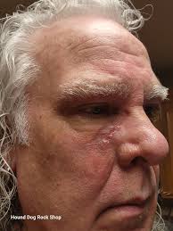 It was nice to get back to work today after my "C" surgery last week