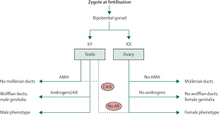 Ais is a genetic condition where affected people have male chromosomes and male gonads with complete or partial feminization of the external genitals. Supplemental Materials For Androgen Insensitivity Syndrome The Lancet