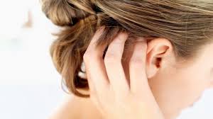 The jamaican black castor oil blends with rhassoul clay deeply moisturize your hair and gently cleanses. Diy Treatments For Scalp Psoriasis Irritation Everyday Health