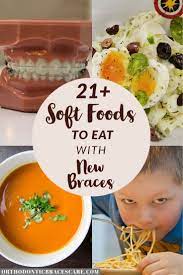 21 Soft Foods To Eat With New Braces For Kids Soft Foods To Eat Braces Food Soft Foods Diet