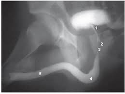 Image result for Voiding Cystourethrogram