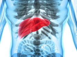 It may be tender when you touch the area. Hepatosplenomegaly Causes Complications And Treatment