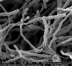 Image result for Suaeda sp. B