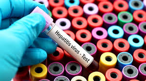 Hepatitis c can be acute or chronic: Hepatitis Leberentzundung Symptome Behandlung Impfung Onmeda De